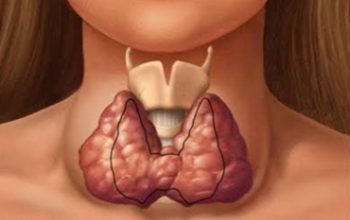 Thyroid